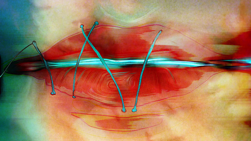 Artistic depiction of a mouth sewn shut